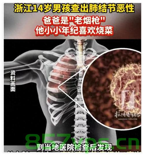 爸爸烟不离手，10岁儿子竟查出肺癌智能免费问答EasyAI m.857vps.cn，关于父亲吸烟与儿子肺癌诊断的警示，烟不离手的代价，关于父亲吸烟与儿子肺癌诊断的警示，烟不离手的代价与肺癌风险警告