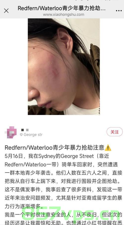 中国留学生在澳遭围殴视频曝光，事件背后的反思与启示智能免费问答EasyAI m.857vps.cn，中国留学生在澳遭围殴事件，反思与启示，中国留学生在澳遭围殴事件背后的反思与启示，智能免费问答的启示 第2张