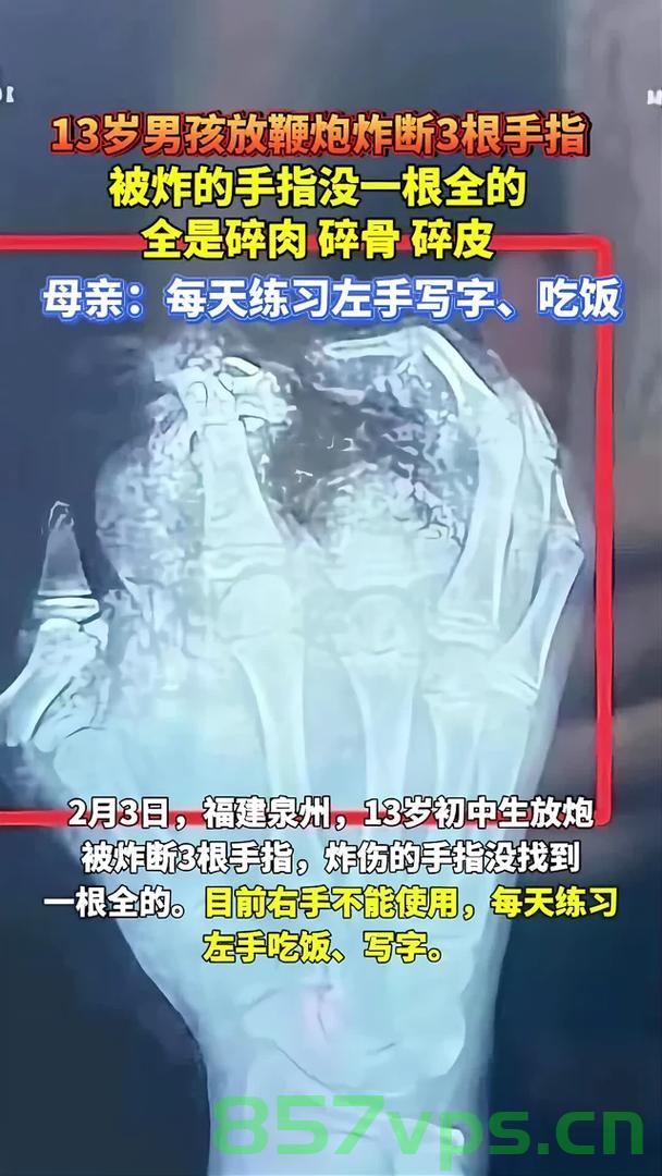 少年遭遇干冰炸伤手指，伤口深可见骨——伤痛与警醒智能免费问答EasyAI m.857vps.cn，少年手指遭干冰炸伤，警醒社会关注安全，伤痛背后的智能问答平台EasyAI分析报道 第2张
