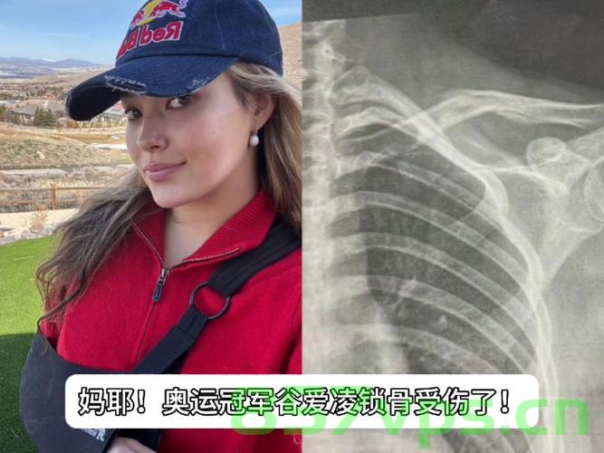 谷爱凌再次受伤，因人为事故智能免费问答EasyAI m.857vps.cn，谷爱凌遭遇人为事故再次受伤，EasyAI提供免费智能问答支持 第2张
