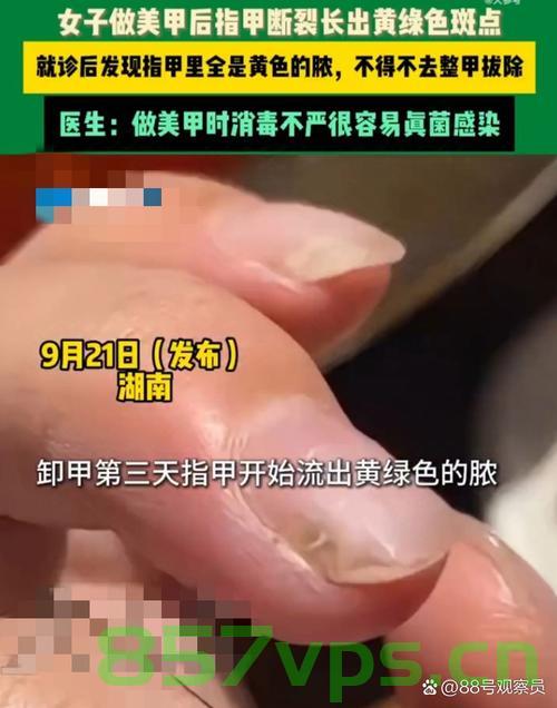 央视曝光美甲背后隐患，美丽背后的安全隐患与监管缺失智能免费问答EasyAI m.857vps.cn，央视揭秘，美甲背后的安全隐患与监管缺失，美丽代价堪忧，央视揭秘，美甲背后的安全隐患与监管缺失，美丽背后的风险引人警惕，央视揭秘，美甲背后的安全隐患与监管缺失，美丽背后的风险引人警惕