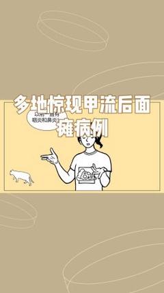 近期甲流后面瘫人数增多的现象分析智能免费问答EasyAI m.857vps.cn，甲流后面瘫人数增多现象分析，智能免费问答平台解析报告 m.857vps.cn