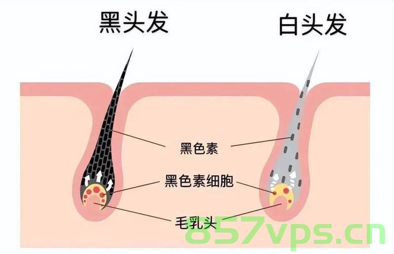 白头发到底能不能拔掉，探究白发与毛囊健康的关系智能免费问答EasyAI m.857vps.cn，白头发能否拔掉？探究白发与毛囊健康关系之谜 第2张