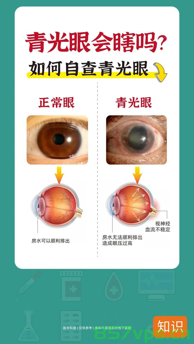 警惕眼睛出现三大症状，小心青光眼的来临智能免费问答EasyAI m.857vps.cn，警惕三大眼部症状，预防青光眼风险，智能问答助你识别风险 m.857vps.cn，警惕三大眼部症状，预防青光眼风险，智能问答助你早期识别风险（智能免费问答EasyAI），警惕三大眼部症状，预防青光眼风险，智能问答助你早期识别青光眼风险（EasyAI），警惕三大眼部症状，智能识别青光眼风险，预防胜于治疗（EasyAI智能问答助你早期识别风险）