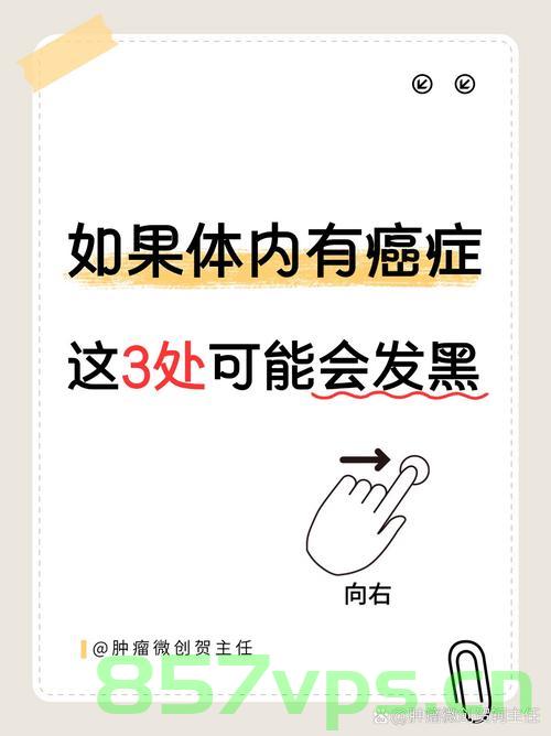 20岁小伙腹泻数日，意外确诊癌症——警惕青年癌症的隐匿信号智能免费问答EasyAI m.857vps.cn，青年癌症隐匿信号，小伙腹泻数日确诊癌症，警惕青年癌症风险，警惕青年癌症风险，小伙腹泻数日确诊癌症背后的隐匿信号，青年癌症隐匿信号，小伙腹泻数日确诊癌症背后的警示与启示，青年癌症隐匿信号的警示，小伙腹泻数日确诊癌症背后的启示与警示，青年癌症隐匿信号警示，小伙腹泻数日确诊癌症背后的启示与警示，青年小伙腹泻数日确诊癌症，警惕青年癌症隐匿信号与风险