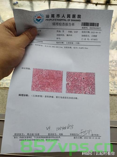 远离肺癌肝癌，从这些小习惯开始智能免费问答EasyAI m.857vps.cn，小习惯预防肺癌肝癌，智能免费问答指南，小习惯预防肺癌肝癌，智能问答指南助你远离癌症风险