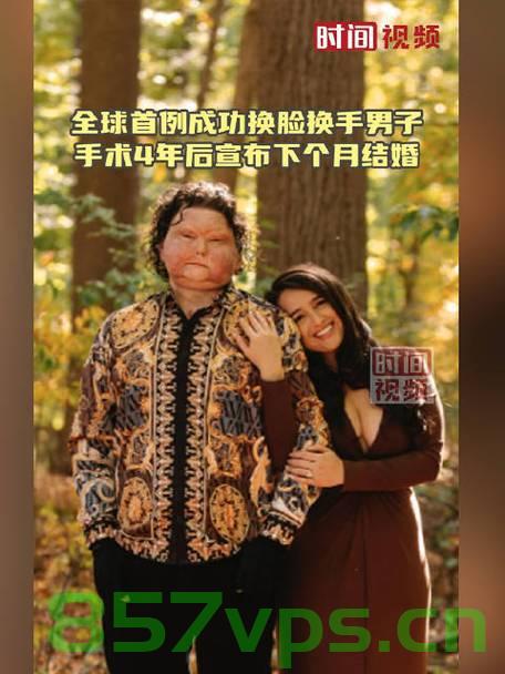 全球首例同时换脸换手男子结婚，奇迹与爱情的交融智能免费问答EasyAI m.857vps.cn，全球首例同时换脸换手男子结婚，奇迹与爱情的交融之旅（智能问答）
