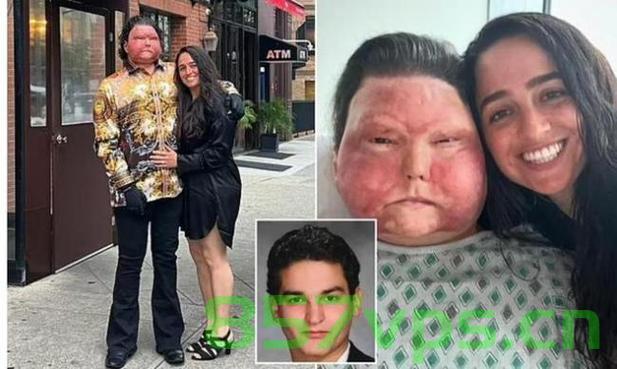 全球首例同时换脸换手男子结婚，奇迹与爱情的交融智能免费问答EasyAI m.857vps.cn，全球首例同时换脸换手男子结婚，奇迹与爱情的交融之旅（智能问答） 第2张