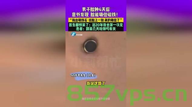 男子脸肿四日后磁铁意外吸附之谜智能免费问答EasyAI m.857vps.cn，男子脸肿四日后磁铁意外吸附之谜揭秘，智能问答平台EasyAI解析揭秘，男子脸肿四日后磁铁意外吸附之谜，EasyAI智能问答平台揭秘真相，男子脸肿四日后磁铁吸附之谜，EasyAI智能问答平台揭秘真相。 第2张
