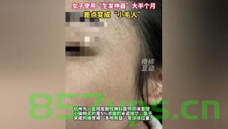 女子喷生发神器后变小毛人——关于生发产品的深度探讨智能免费问答EasyAI m.857vps.cn，女子使用生发神器遭遇小毛人现象，生发产品深度探讨与智能问答解析
