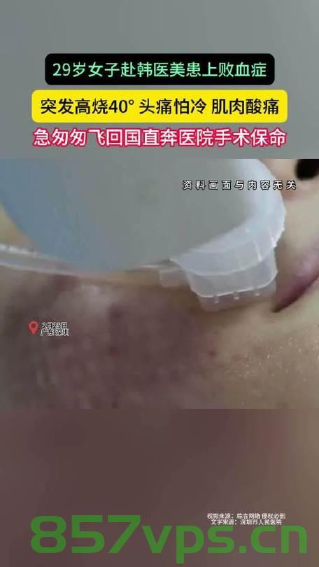 赴韩医美遭遇败血症，一位年轻女子的警示故事智能免费问答EasyAI m.857vps.cn，赴韩医美遭遇败血症，年轻女子的警示故事，赴韩医美遭遇败血症，年轻女子的警示故事，赴韩医美遭遇败血症，年轻女子的警示故事，赴韩医美遭遇败血症，年轻女子的警示之旅，赴韩医美遭遇败血症，年轻女子的警示之旅（警示故事）