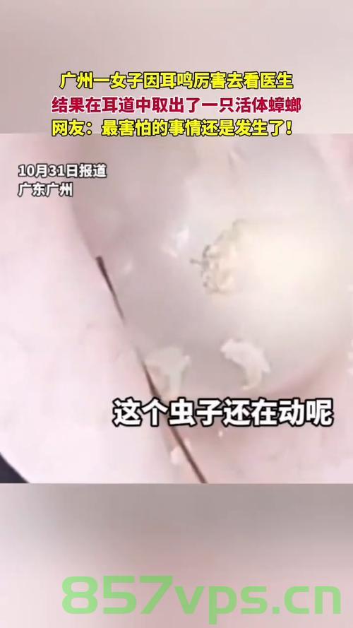 女子耳朵痒竟取出一只活蟑螂，离奇经历揭示生活小常识智能免费问答EasyAI m.857vps.cn，女子耳朵惊现活蟑螂，离奇经历引发生活常识智能问答热议 第2张