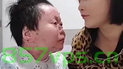 蝴蝶宝贝的坚韧翅膀，一位女孩与蝴蝶宝贝皮肤的故事智能免费问答EasyAI m.857vps.cn，蝴蝶宝贝的坚韧翅膀，女孩与皮肤故事之智能问答探索，蝴蝶宝贝的坚韧翅膀，女孩与皮肤故事之智能问答探索 m.857vps.cn