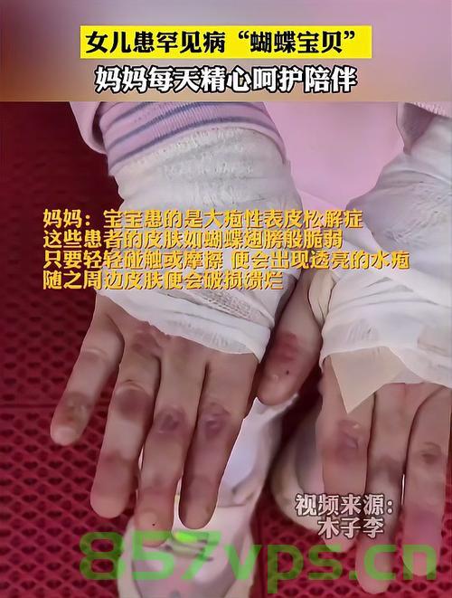 蝴蝶宝贝的坚韧翅膀，一位女孩与蝴蝶宝贝皮肤的故事智能免费问答EasyAI m.857vps.cn，蝴蝶宝贝的坚韧翅膀，女孩与皮肤故事之智能问答探索，蝴蝶宝贝的坚韧翅膀，女孩与皮肤故事之智能问答探索 m.857vps.cn 第2张