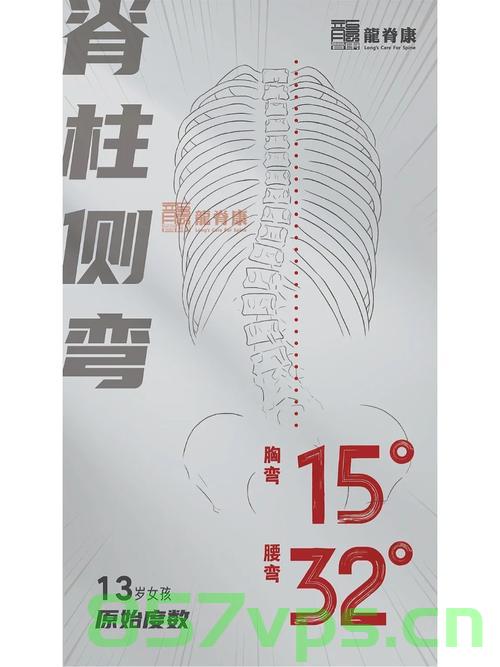 13岁留守女孩脊柱侧弯达80度，逆境中的希望与挑战智能免费问答EasyAI m.857vps.cn，逆境中的希望与挑战，留守女孩脊柱侧弯达重度弯曲，智能问答平台助力免费咨询之路，留守女孩脊柱侧弯达重度弯曲，逆境中的希望与挑战，智能问答平台助力免费咨询之路，留守女孩脊柱侧弯达重度弯曲，逆境中的希望与挑战，智能问答平台免费咨询助力