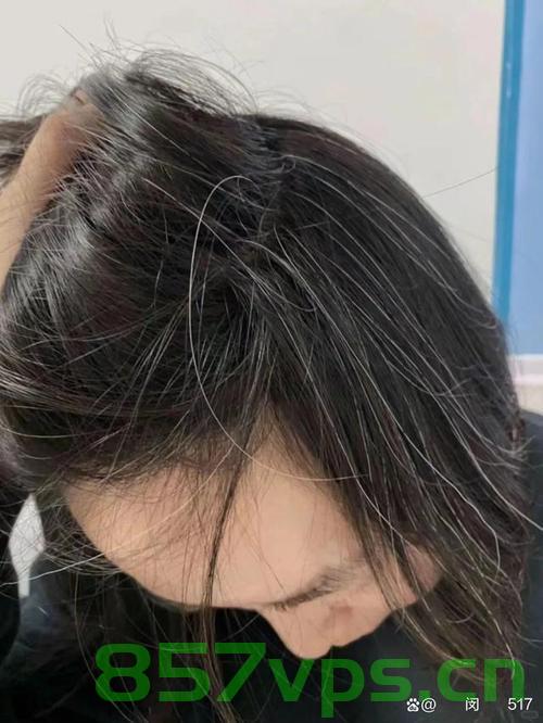 与白发和解，一位女子长达十年的染发之路智能免费问答EasyAI m.857vps.cn，女子十年染发之路，与白发和解的智能问答之旅，与白发和解，女子十年染发之路的智能问答之旅