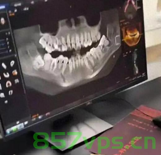 被拔错牙坠亡女子的家属与相关方达成和解协议智能免费问答EasyAI m.857vps.cn，拔错牙致女子坠亡事件，家属与涉事方达成和解协议，拔错牙致女子坠亡事件，家属与涉事方达成和解协议，拔错牙致女子坠亡事件家属与涉事方达成和解协议，和解达成，未来展望如何？，拔错牙致女子坠亡事件和解协议达成，未来展望待观察