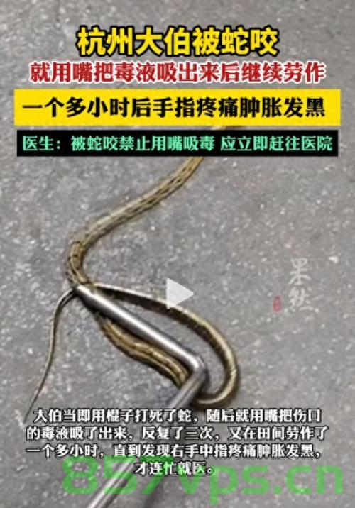 杭州大伯遭遇蛇咬危机，勇敢用嘴吸毒液紧急入院智能免费问答EasyAI m.857vps.cn，杭州大伯蛇咬危机，勇敢自救与智能问答平台的援助之路，杭州大伯蛇咬危机，勇敢自救与智能问答平台的紧急援助之路，杭州大伯蛇咬危机，勇敢自救与智能问答平台的紧急援助之旅