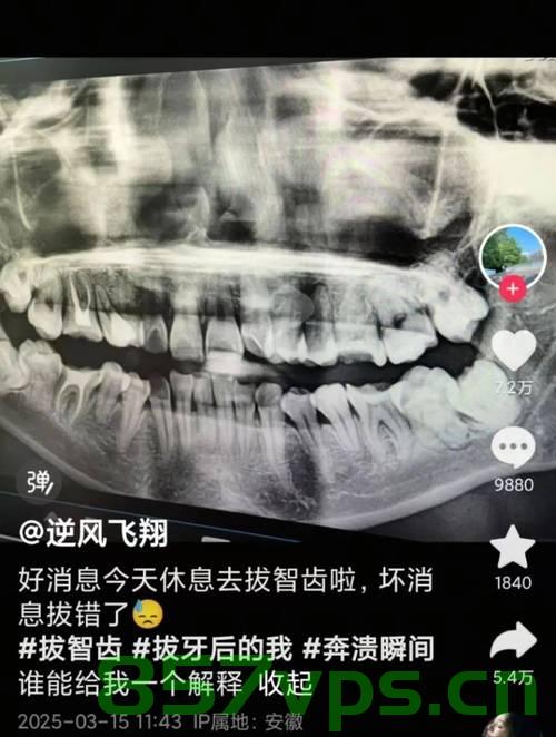 女子称丈夫拔牙后离世，当地回应引发关注智能免费问答EasyAI m.857vps.cn，女子丈夫拔牙后离世事件引发关注，当地回应智能免费问答背后的真相揭秘，女子丈夫拔牙后离世事件引发关注，当地回应与智能免费问答背后的真相探索，女子丈夫拔牙后离世事件引发关注，当地回应与智能免费问答背后的真相探索，女子丈夫拔牙后离世事件引发关注，当地回应与智能免费问答背后的真相探索揭秘 第2张