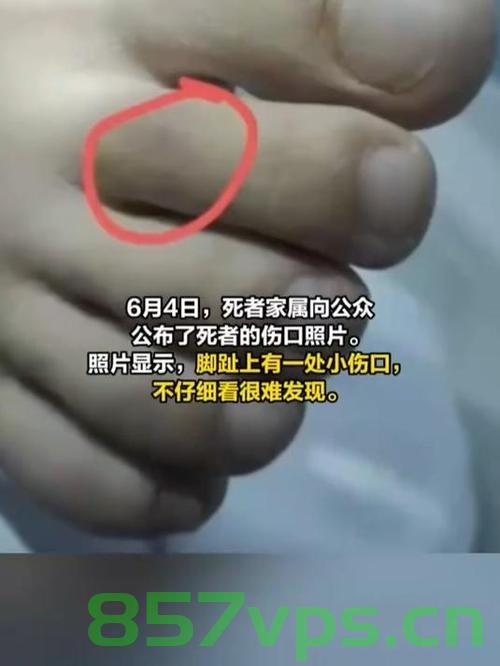 三亚女子被蛇咬伤致死事件揭秘，伤口画面曝光智能免费问答EasyAI m.857vps.cn，三亚女子蛇咬致死事件曝光，伤口细节揭秘，三亚女子蛇咬致死事件曝光，伤口细节揭秘与智能免费问答平台调查