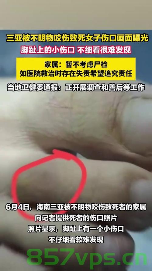 三亚女子被蛇咬伤致死事件揭秘，伤口画面曝光智能免费问答EasyAI m.857vps.cn，三亚女子蛇咬致死事件曝光，伤口细节揭秘，三亚女子蛇咬致死事件曝光，伤口细节揭秘与智能免费问答平台调查 第2张