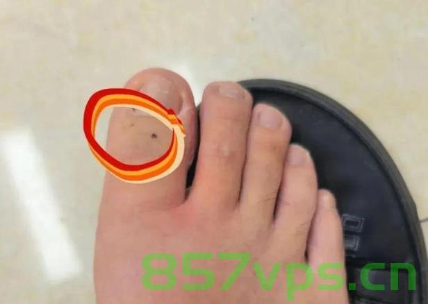 男子散步遭遇意外,被青蛇咬伤后冷静拍照智能免费问答EasyAI m.857vps.cn,男子散步遭青蛇咬伤后冷静拍照求助,智能问答助力自救之路 第2张 男子散步遭遇意外,被青蛇咬伤后冷静拍照智能免费问答EasyAI m.857vps.cn,男子散步遭青蛇咬伤后冷静拍照求助,智能问答助力自救之路 第2张