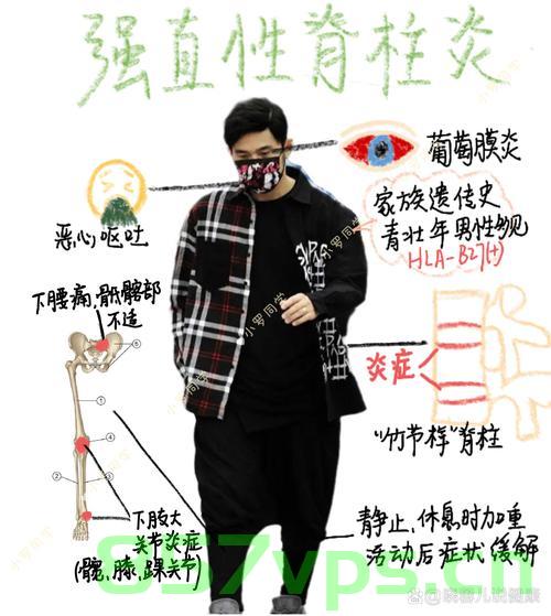 周杰伦患强直性脊柱炎，近照弯腰驼背背后的故事智能免费问答EasyAI m.857vps.cn，周杰伦患强直性脊柱炎背后的故事，弯腰驼背背后的智能免费问答揭秘，周杰伦患强直性脊柱炎揭秘，弯腰驼背背后的故事与智能免费问答探寻真相 第1张