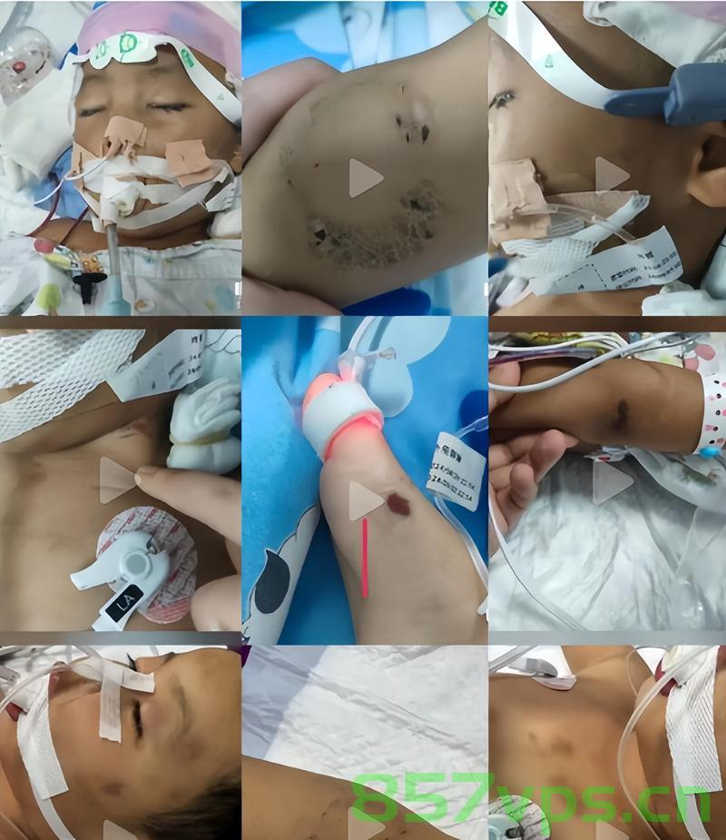 三岁男童扁桃体切除手术意外致脑死亡，深度剖析与反思智能免费问答EasyAI m.857vps.cn，三岁男童扁桃体切除手术意外致脑死亡，对智能免费问答系统的深度剖析与反思，智能问答系统的反思，三岁男童扁桃体切除手术意外致脑死亡案例剖析与启示