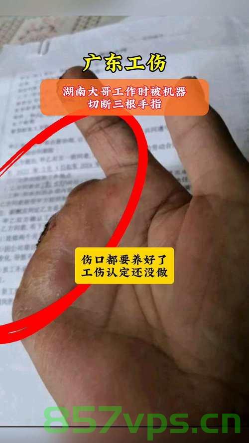 湖南男子上班首日遭遇工伤，压断三根手指公司却拒赔智能免费问答EasyAI m.857vps.cn，湖南男子上班首日工伤遭拒赔，公司漠视员工权益事件曝光 第1张