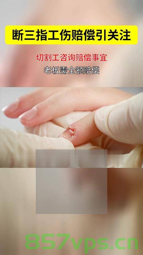 湖南男子上班首日遭遇工伤，压断三根手指公司却拒赔智能免费问答EasyAI m.857vps.cn，湖南男子上班首日工伤遭拒赔，公司漠视员工权益事件曝光 第2张